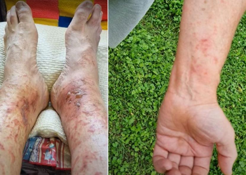Kunigui Robertui Gedvydui Skrinskui jo paties puoselėjamos lysvės tapo skausmingų išbandymų šaltiniu. Klebono R. Skrinsko nuotr. 